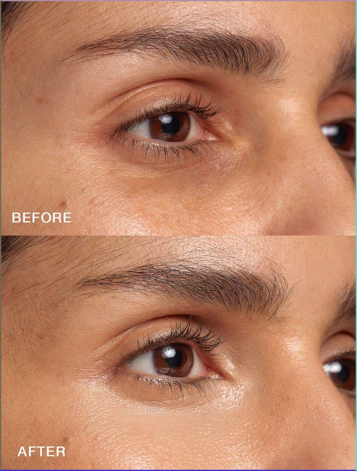 Kaschier-Concealer, 25 Medium Neutral